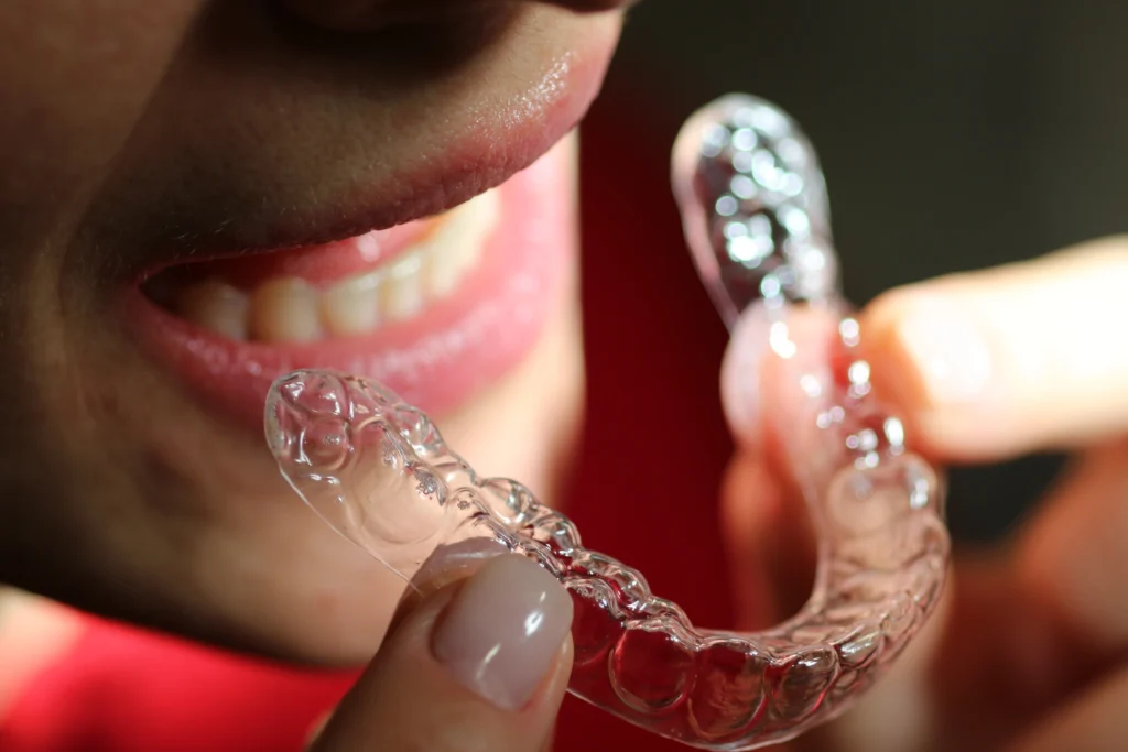Allineatori dentali